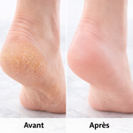 Charger l'image dans la galerie, CYNDINAL : Dites enfin ADIEU aux talons fissurés et mains sèches en quelques jours !
