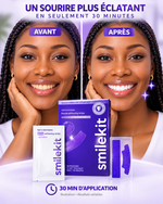 Charger l'image dans la galerie, Bande blanchissante violette : Révélez l’éclat naturel de votre sourire
