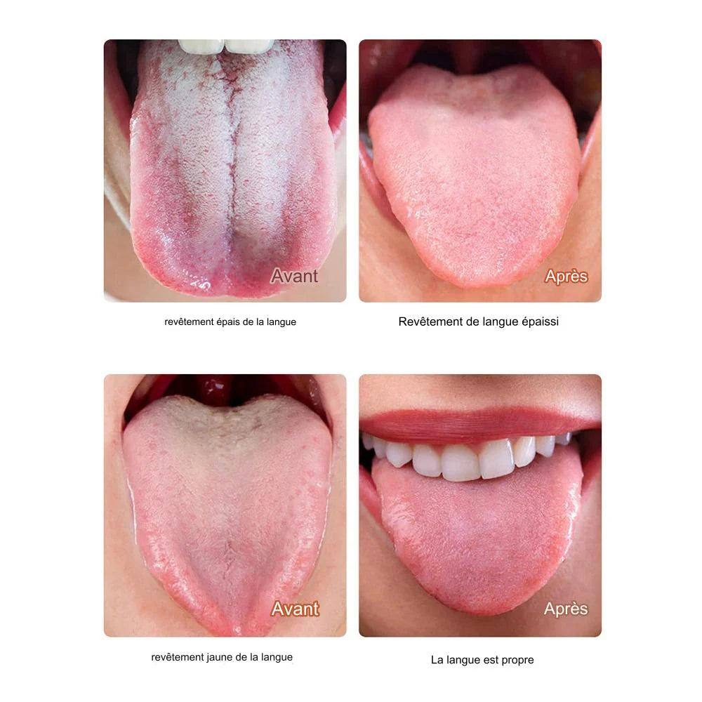 Pack Anti-Mauvaise Haleine : Gratte-Langue + Gel