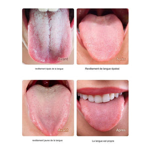 Pack Anti-Mauvaise Haleine : Gratte-Langue + Gel